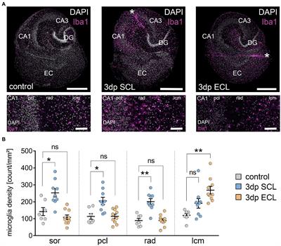 Denervated mouse CA1 pyramidal neurons express homeostatic synaptic plasticity following entorhinal cortex lesion